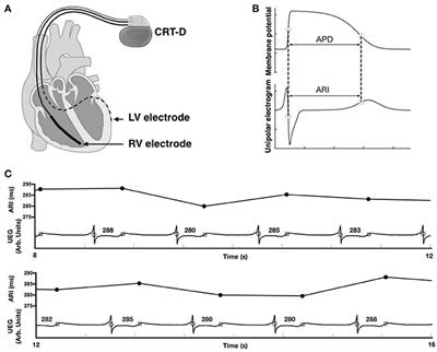 Beat-to-Beat Variability of Ventricular Action Potential Duration Oscillates at Low Frequency During Sympathetic Provocation in Humans